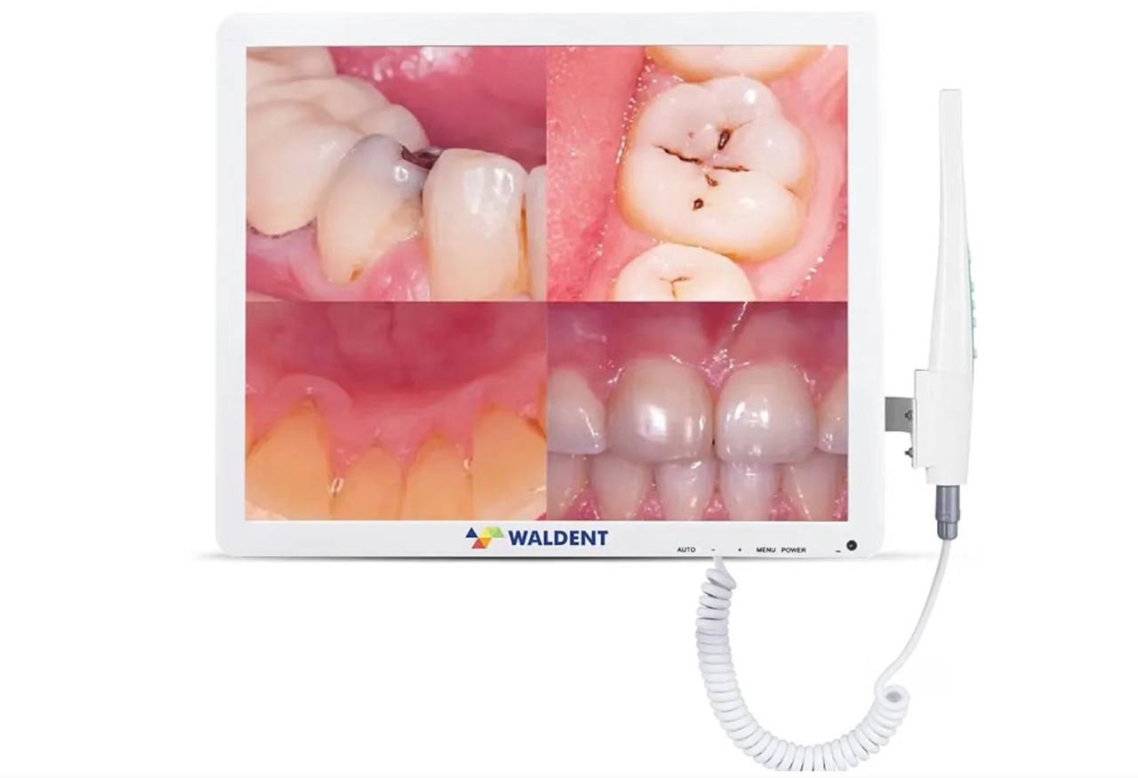 Intraoral camera