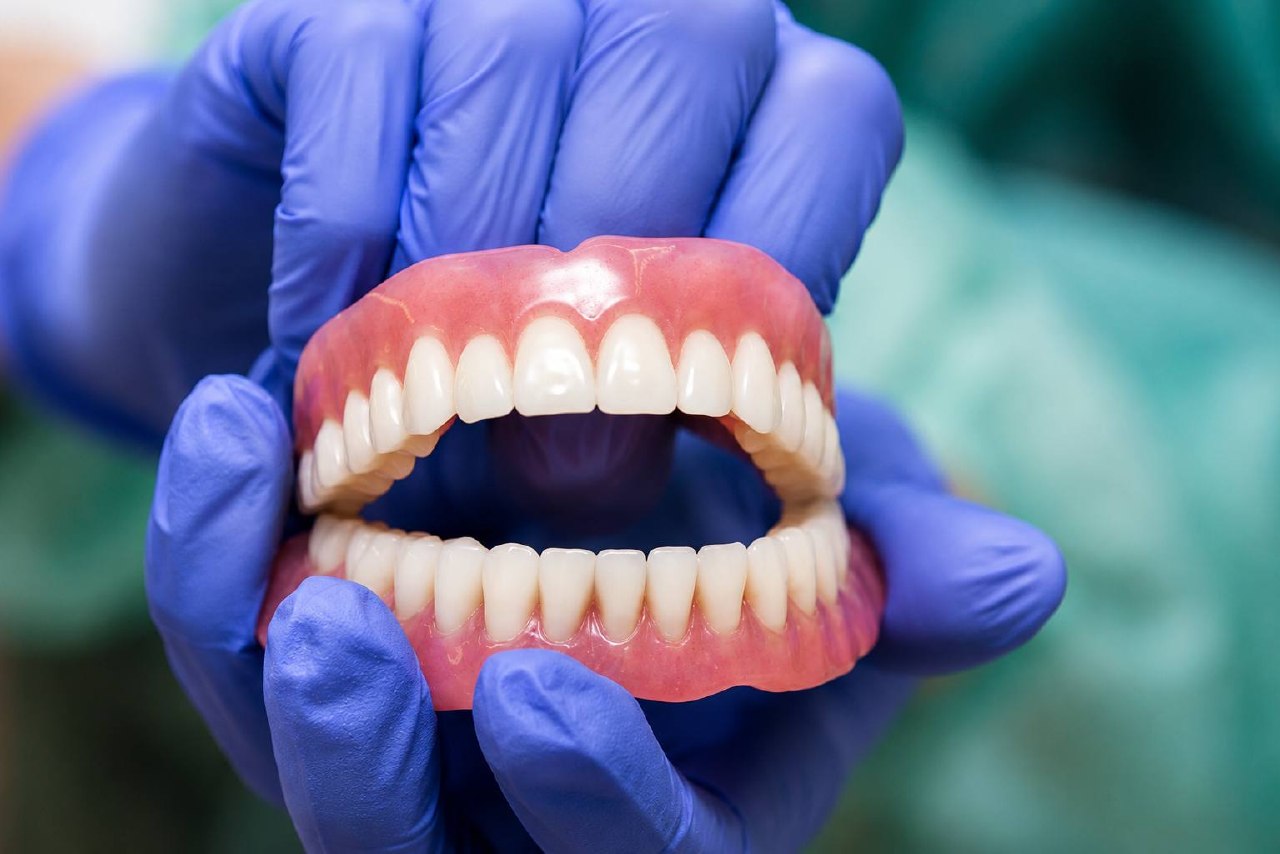 Complete Dentures