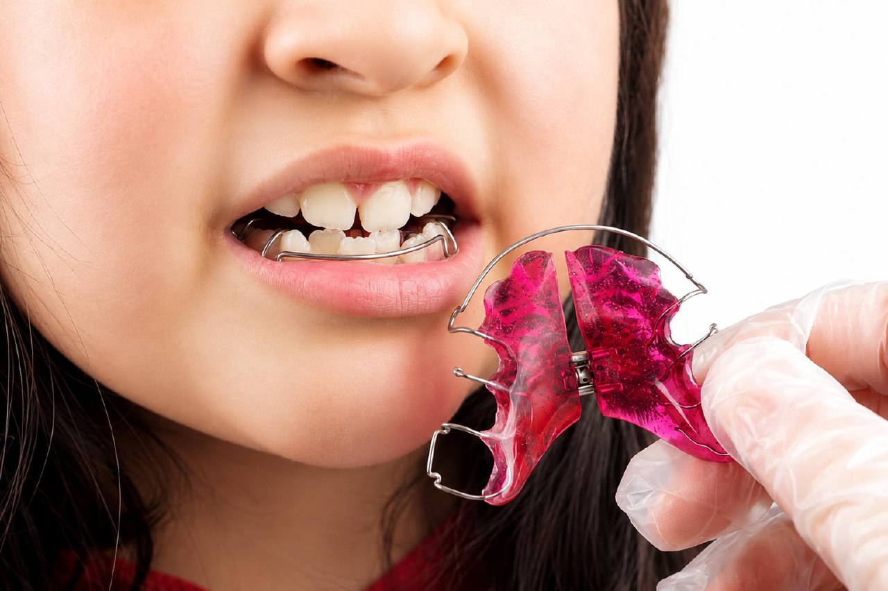 Interceptive Orthodontics