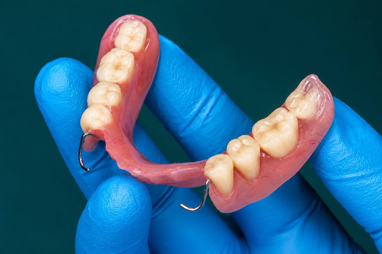 Removable Partial Dentures